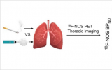 电子烟的潜在危害:PET成像显示，电子烟使用者的肺部炎症比吸烟者更严重