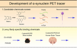 一种新的正电子发射断层扫描示踪剂，可显示突触核蛋白病变